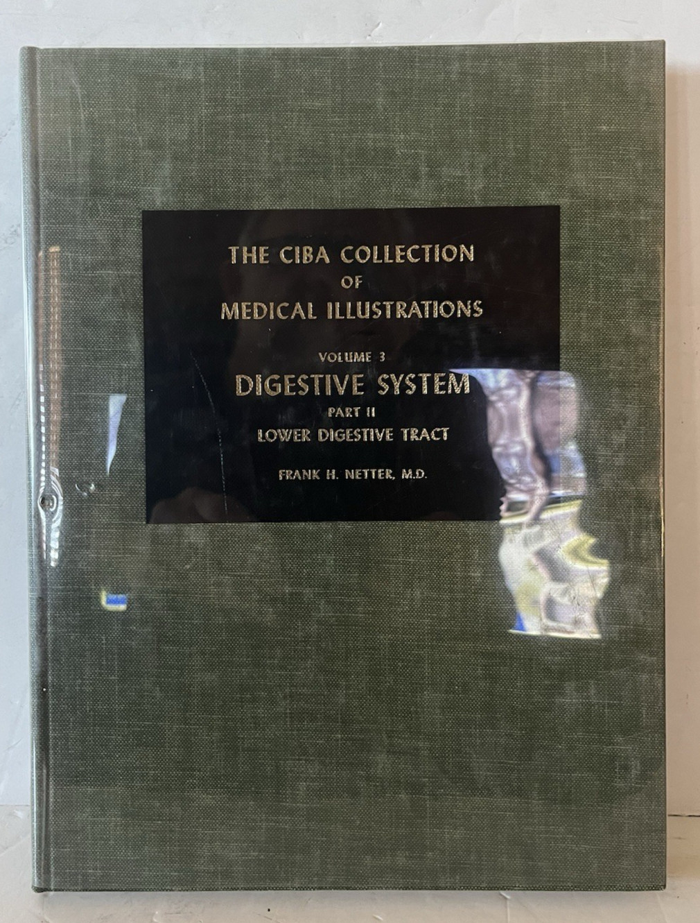 The CIBA Collection of Medical Illustration Vol. 3 Part 2 Lower Digestive Tract